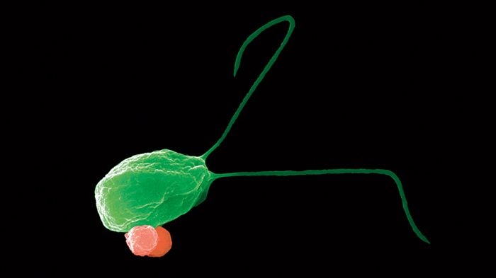 Зелена водорость з вантажем – двома полімерними кульками, начиненими ліками. На одному кінці у водорості є два джгутики, за допомогою яких вона рухається. (Фото: O. Yasa et al., Advanced Materials, 2018)