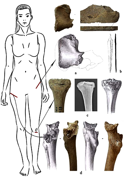 Схема смертельних поранень, нанесених дівчині. Фото: A.Yu. Khudaverdyan and al. / International Journal of Osteoarchaeology.   