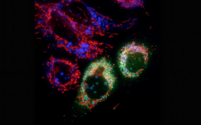 Клітини людини з жировими краплями (пофарбовані синім). (Фото: Marta Bosch / Universitat de Barcelona)
