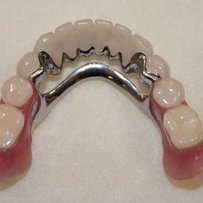 Лікування зубів для ветерана праці