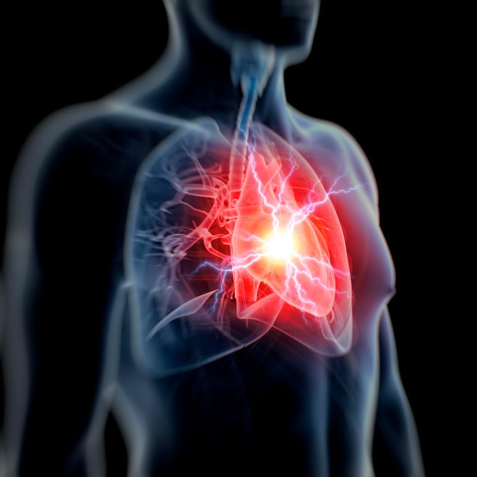 Понад 25% випадків смерті від серцевих захворювань у людей у віці до 75 років