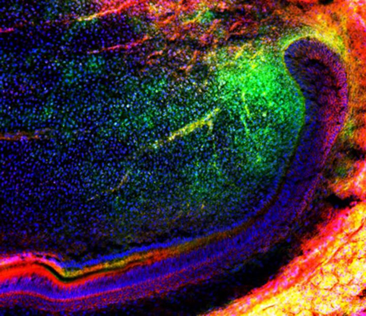 На зображенні показано групу мезенхімальних (зелених) стовбурових клітин, що мігрують в зуб для подальшої регенерації тканин