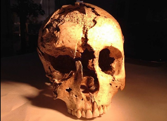 Череп римлянки з Анседонії. Фото: Gismondi A. et al. / Archaeological and Anthropological Sciences.