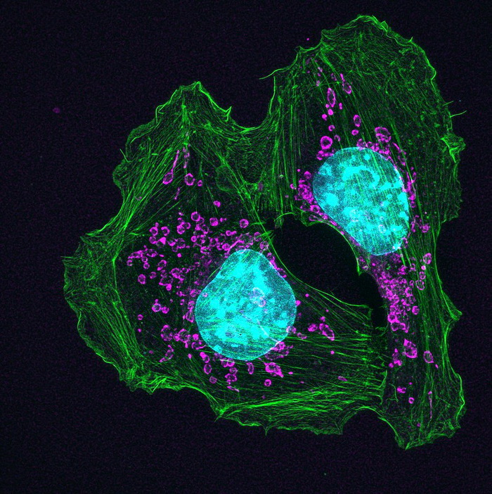Клітини раку шкіри. (Фото: NIH Image Gallery / Flickr.com) Відкрити в повному розмірі