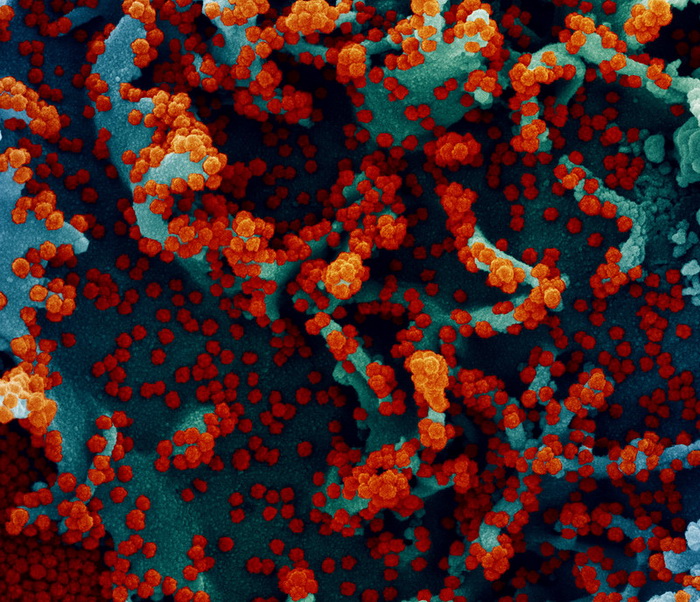 Частинки коронавірусу SARS-CoV-2 на поверхні клітини. (Фото: NIAID / Flickr.com)