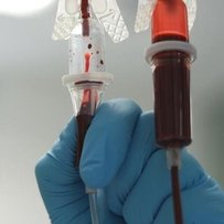 Через недофінансування Черкаська обласна станція переливання крові не може успішно працювати