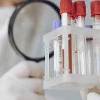 Що змінилося в тестуванні на COVID-19